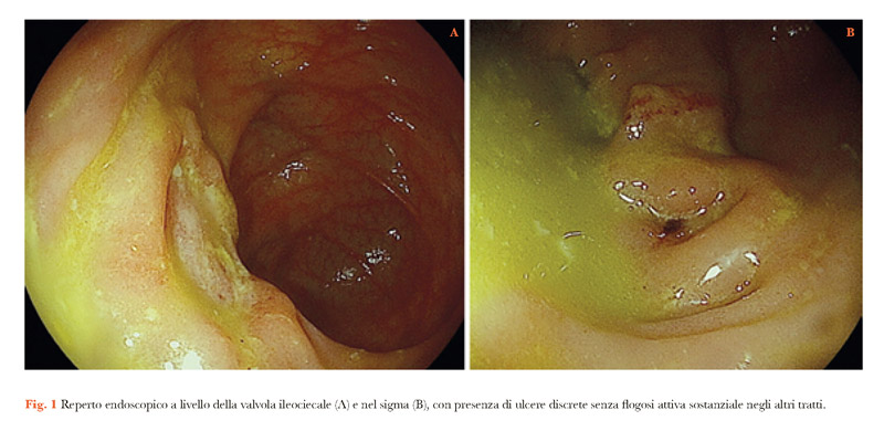 fig1